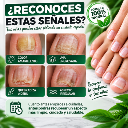 Recupera tu Confianza y di Adiós a los Hongos